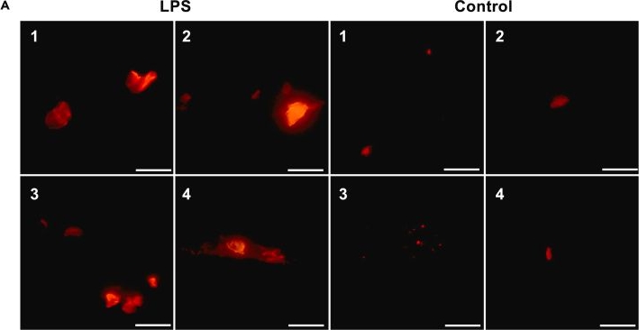 Fig.3.A showing Immunocytochemistry-immunofluorescence from the publication: Selective protein aggregation confines and inhibits endotoxins in wounds: Linking host defense to amyloid formation.