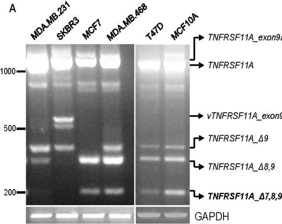 Fig.3.A showing Western Blotting from the publication: Identification of novel human receptor activator of nuclear factor-kB isoforms generated through alternative splicing: implications in breast cancer cell survival and migration.