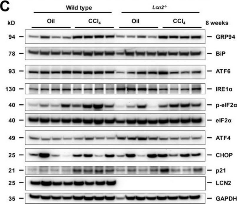 Fig.1.C showing Western Blotting in a Mus musculus (House mouse) sample from the publication: Chronic Carbon Tetrachloride Applications Induced Hepatocyte Apoptosis in Lipocalin 2 Null Mice Through Endoplasmic Reticulum Stress and Unfolded Protein Response.