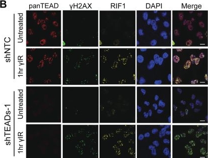 Fig.3.B showing Immunocytochemistry-immunofluorescence from the publication: TEAD Proteins Associate With DNA Repair Proteins to Facilitate Cellular Recovery From DNA Damage.