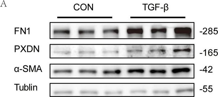 Fig.7.A showing Western Blotting from the publication: A compact five-gene immuno-fibrotic profile distinguishing systemic sclerosis subtypes with PXDN validated as a fibrosis-associated target.
