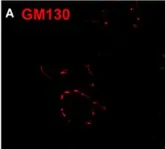 Fig.6.A showing Immunohistochemistry-immunofluorescence in a Rattus norvegicus (Rat) sample from the publication: Novel insights into the distribution and functional aspects of the calcium binding protein secretagogin from studies on rat brain and primary neuronal cell culture.