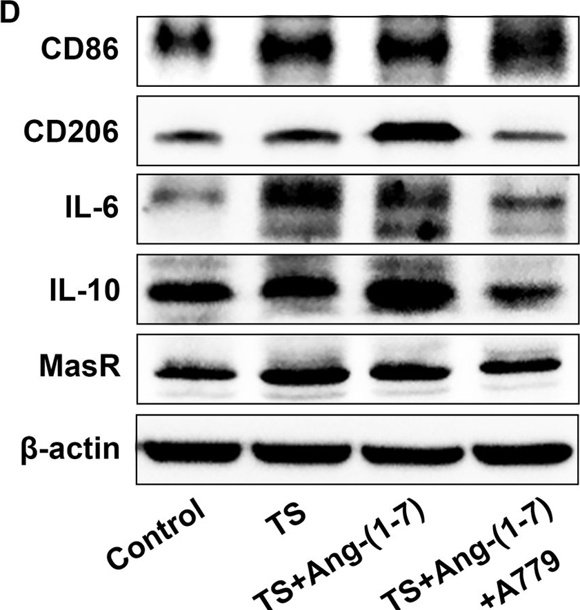 Fig.2.D showing Western Blotting in a Mus musculus (House mouse) sample from the publication: The Ang-(1-7)/MasR axis ameliorates neuroinflammation in hypothermic traumatic brain injury in mice by modulating phenotypic transformation of microglia.