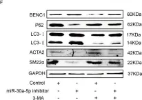 Fig.4.F showing Western Blotting in a Homo sapiens (Human) sample from the publication: Myocardin/microRNA-30a/Beclin1 signaling controls the phenotypic modulation of vascular smooth muscle cells by regulating autophagy.