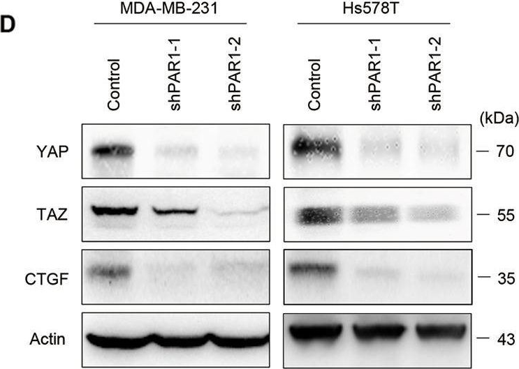 Fig.4.D showing Western Blotting from the publication: Twist-mediated PAR1 induction is required for breast cancer progression and metastasis by inhibiting Hippo pathway.