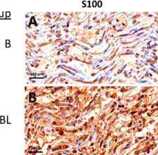 Fig.2.P showing Immunohistochemistry in a Rattus norvegicus (Rat) sample from the publication: Methylcobalamin in Combination with Early Intervention of Low-Intensity Pulsed Ultrasound Potentiates Nerve Regeneration and Functional Recovery in a Rat Brachial Plexus Injury Model.