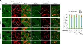 Fig.2.A showing Immunocytochemistry-immunofluorescence from the publication: Mitochondrial Rab GAPs govern autophagosome biogenesis during mitophagy.