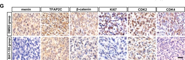 Fig.6.G showing Immunohistochemistry in a Mus musculus (House mouse) sample from the publication: Menin facilitates the cell proliferation of bladder cancer via modulating the TFAP2C/β-catenin axis.