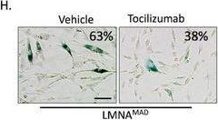 Fig.7.H from the publication: MAM-STAT3-Driven Mitochondrial Ca+2 Upregulation Contributes to Immunosenescence in Type A Mandibuloacral Dysplasia Patients.