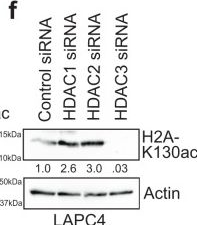 Fig.1.F showing Western Blotting in a Mus musculus (House mouse) sample from the publication: Histone H2A Lys130 acetylation epigenetically regulates androgen production in prostate cancer.