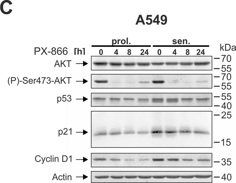 Fig.5.C showing Western Blotting from the publication: Combined inhibition of class 1-PI3K-alpha and delta isoforms causes senolysis by inducing p21WAF1/CIP1 proteasomal degradation in senescent cells.