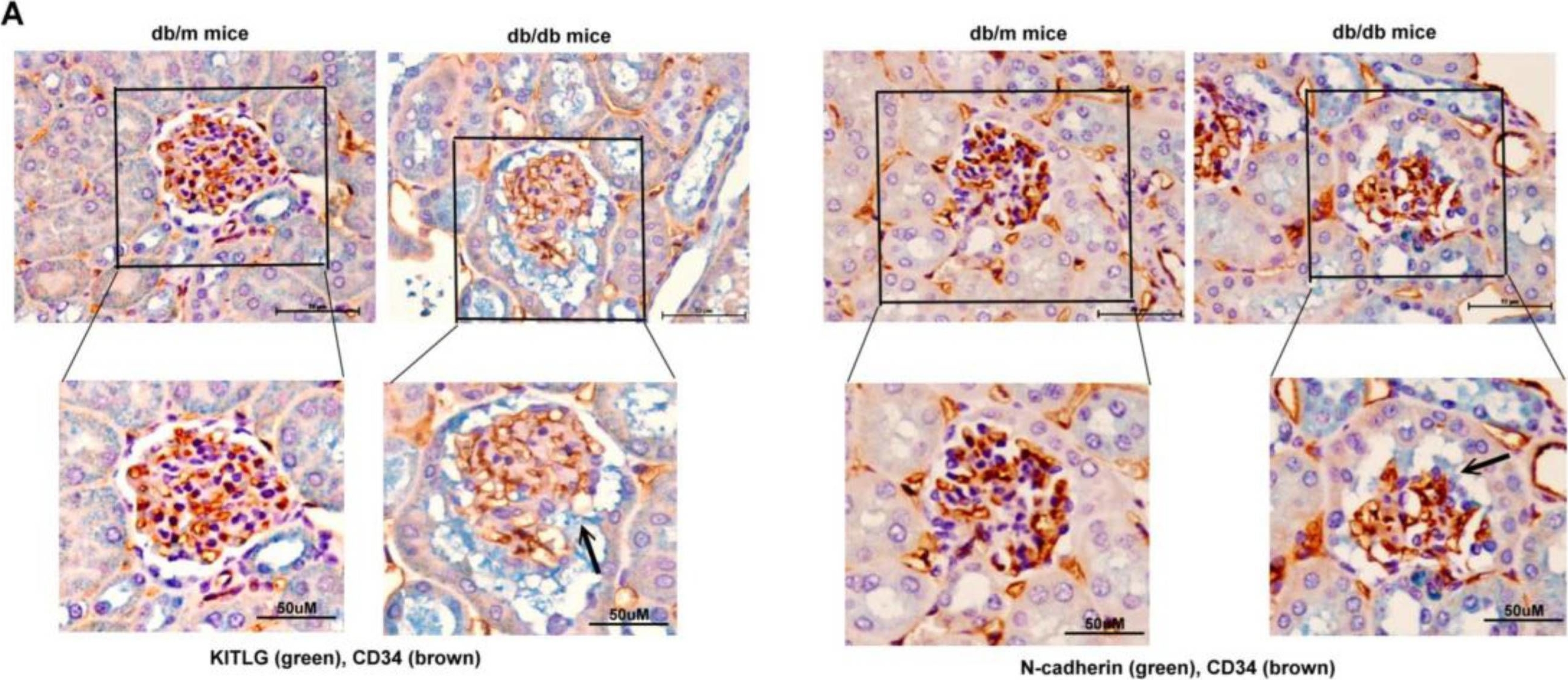 Fig.5.A showing Immunohistochemistry from the publication: KITLG Promotes Glomerular Endothelial Cell Injury in Diabetic Nephropathy by an Autocrine Effect.