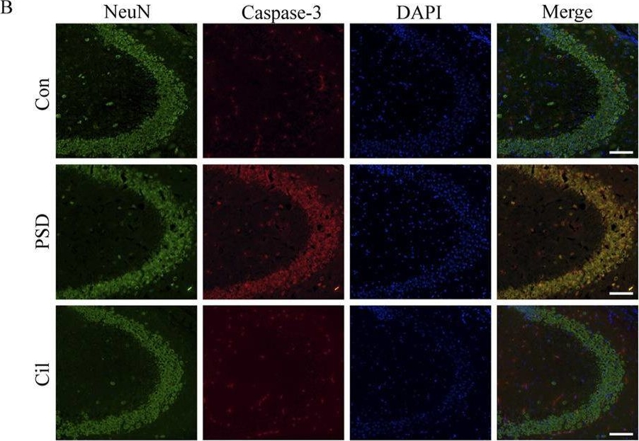 Fig.2.B showing Immunocytochemistry-immunofluorescence in a Mus musculus (House mouse) sample from the publication: Cilostazol-inhibited RhoA/NF-κB signaling mitigates hippocampal inflammation and post-stroke depression.