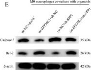 Fig.5.E showing Western Blotting from the publication: ZFP36L1 promotes non-small cell lung cancer progression under hypoxia by modulating CXCL9:SPP1 polarity: A single-cell transcriptomic study.
