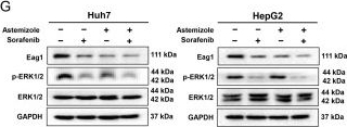 Fig.3.G showing Western Blotting in a Homo sapiens (Human) sample from the publication: The Antihistamine Astemizole Potentiates the Antitumor Efficacy of Sorafenib in Hepatocellular Carcinoma by Suppressing Proliferation, Metastasis, and Angiogenesis.
