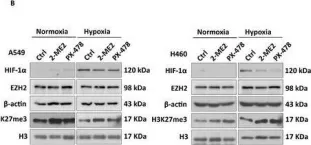 Fig.1.B showing Western Blotting from the publication: The Interplay Between HIF-1α and EZH2 in Lung Cancer and Dual-Targeted Drug Therapy.