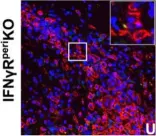 Fig.7.U showing Immunocytochemistry-immunofluorescence in a Mus musculus (House mouse) sample from the publication: IFN-gamma signaling in the central nervous system controls the course of experimental autoimmune encephalomyelitis independently of the localization and composition of inflammatory foci.