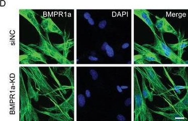 Fig.3.D showing Immunocytochemistry-immunofluorescence in a Rattus norvegicus (Rat) sample from the publication: Opsin-Free Activation of Bmp Receptors by a Femtosecond Laser.