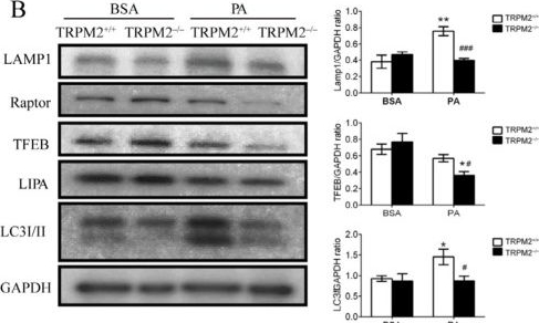 Fig.6.B showing Western Blotting from the publication: TRPM2 Promotes Lipophagy Through TFEB and LAL in HFD-Fed Mice.