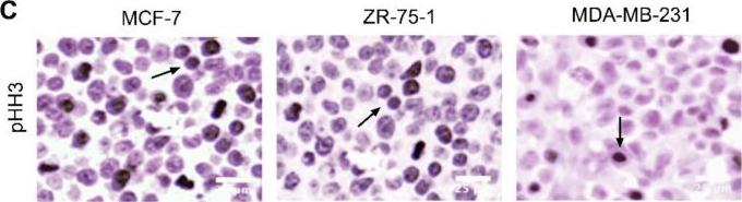Fig.9.C showing Immunohistochemistry in a Homo sapiens (Human) sample from the publication: 3D Multicellular Stem-Like Human Breast Tumor Spheroids Enhance Tumorigenicity of Orthotopic Xenografts in Athymic Nude Rat Model.