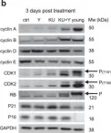 Fig.5.B showing Western Blotting from the publication: Co-inhibition of ATM and ROCK synergistically improves cell proliferation in replicative senescence by activating FOXM1 and E2F1.