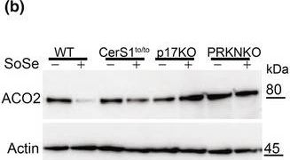 Fig.3.B showing Western Blotting from the publication: Alterations of lipid-mediated mitophagy result in aging-dependent sensorimotor defects.
