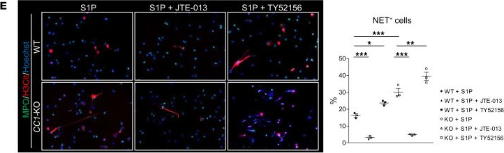 Fig.4.E from the publication: Neutrophil CEACAM1 determines susceptibility to NETosis by regulating the S1PR2/S1PR3 axis in liver transplantation.