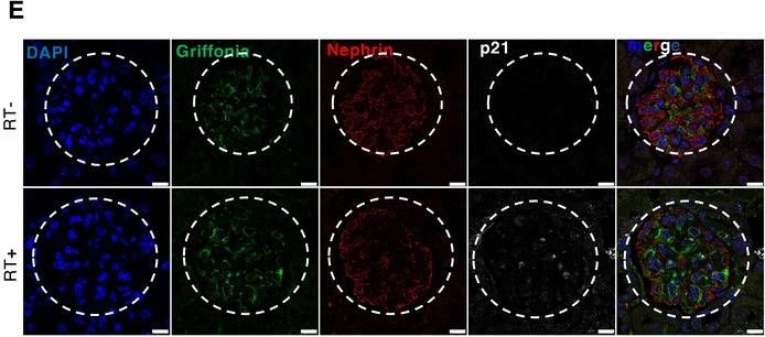 Glomerular endothelial cell senescence drives age-related kidney disease through PAI-1.