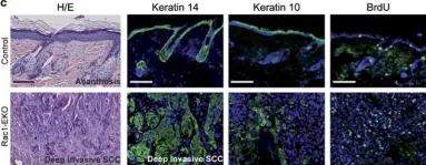 Fig.8.C showing Immunohistochemistry in a Mus musculus (House mouse) sample from the publication: Epidermal Rac1 regulates the DNA damage response and protects from UV-light-induced keratinocyte apoptosis and skin carcinogenesis.