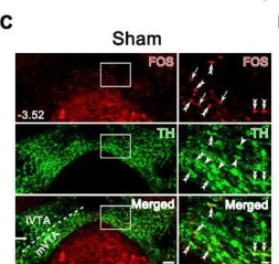 Fig.3.C showing Immunohistochemistry-immunofluorescence in a Mus musculus (House mouse) sample from the publication: Modulation of comorbid depression of neuropathic pain by dopamine input from VTA to the ventral hippocampus.