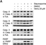 Fig.3.A showing Western Blotting in a Homo sapiens (Human) sample from the publication: Vemurafenib Limits Influenza A Virus Propagation by Targeting Multiple Signaling Pathways.