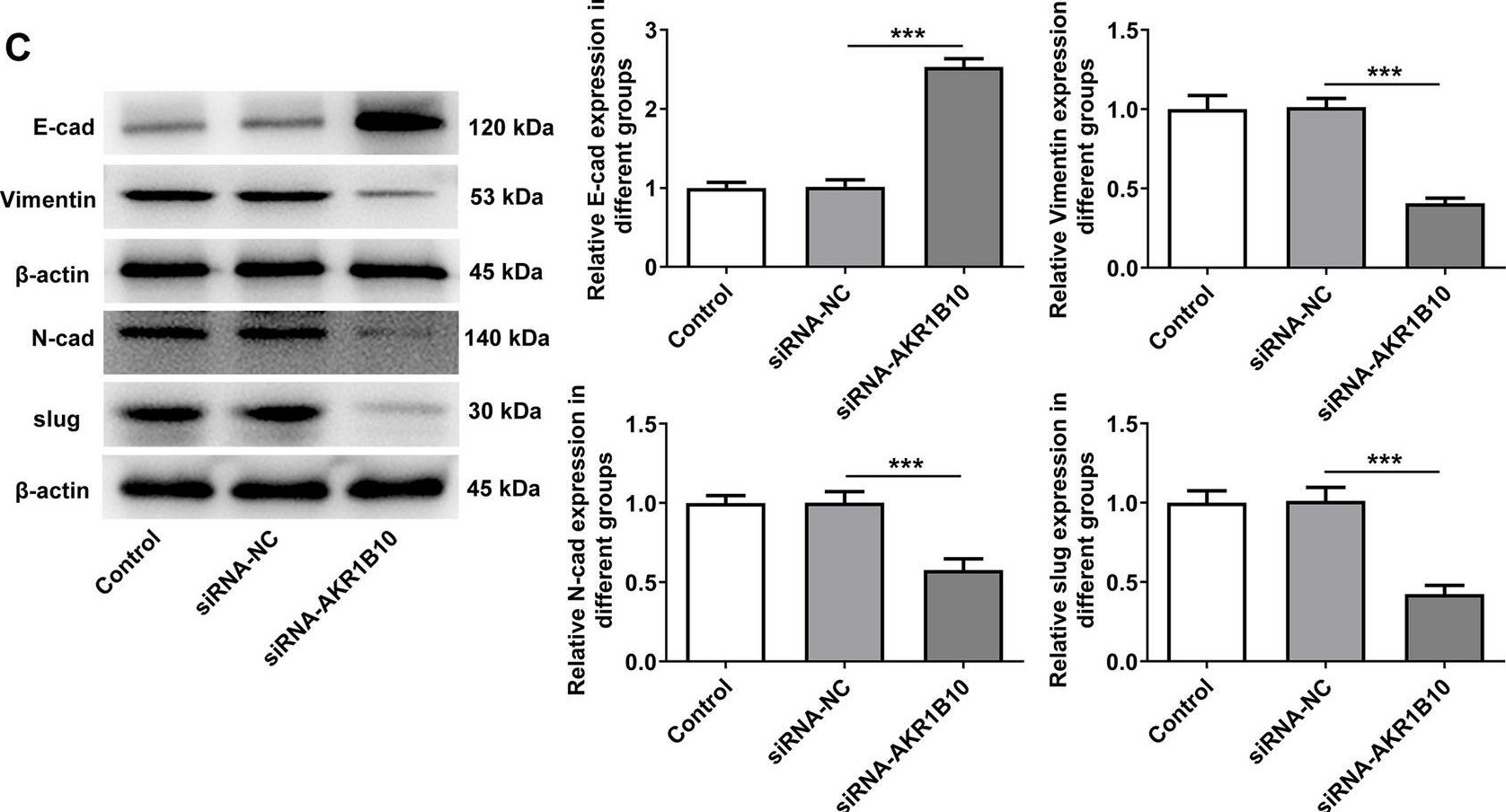 Fig.3.C showing Western Blotting in a Homo sapiens (Human) sample from the publication: AKR1B10 accelerates glycolysis through binding HK2 to promote the malignant progression of oral squamous cell carcinoma.