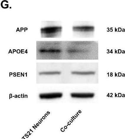 Fig.1.G showing Western Blotting from the publication: The Therapeutic Potential of ADSC-Secreted LEFTY2 in Treating Alzheimer's Disease.