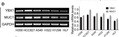 Fig.1.D showing Western Blotting in a Homo sapiens (Human) sample from the publication: YBX1 Enhances Metastasis and Stemness by Transcriptionally Regulating MUC1 in Lung Adenocarcinoma.