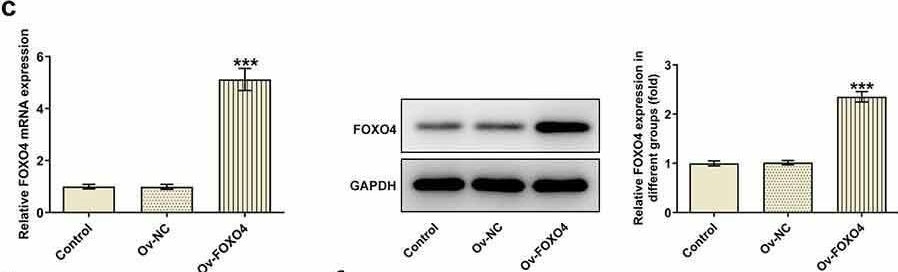 Fig.4.C showing Western Blotting from the publication: C1q/tumor necrosis factor-related protein-3 (CTRP3) activated by forkhead box O4 (FOXO4) down-regulation protects retinal pericytes against high glucose-induced oxidative damage through nuclear factor erythroid 2-related factor 2 (Nrf2)/Nuclear factor-kappaB (NF-κB) signaling.