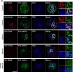 Fig.5.E showing Immunocytochemistry-immunofluorescence from the publication: Integrin-beta3 clusters recruit clathrin-mediated endocytic machinery in the absence of traction force.