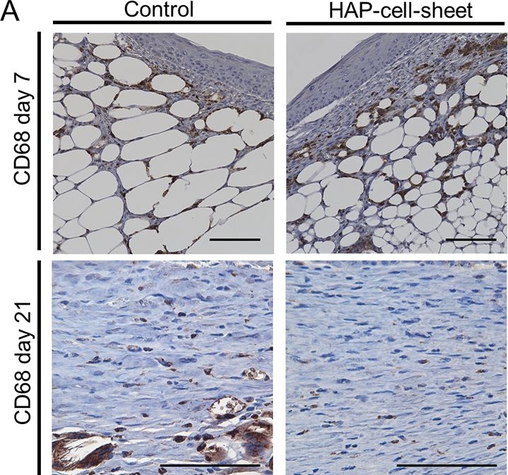 Fig.5.A showing Immunohistochemistry in a Mus musculus (House mouse) sample from the publication: Hair-follicle associated pluripotent (HAP)-cell-sheet implantation enhanced wound healing in diabetic db/db mice.