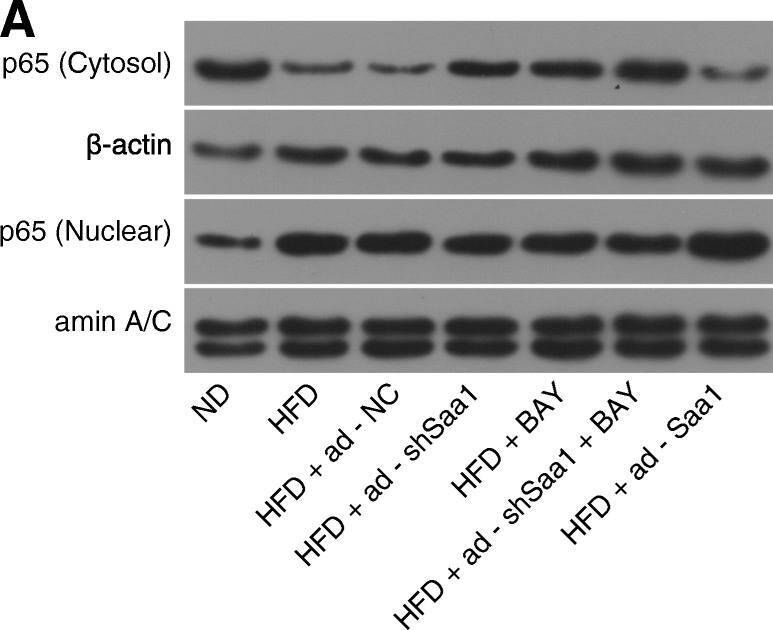 Fig.5.A showing Western Blotting in a Mus musculus (House mouse) sample from the publication: Silencing of SAA1 inhibits palmitate- or high-fat diet induced insulin resistance through suppression of the NF-κB pathway.