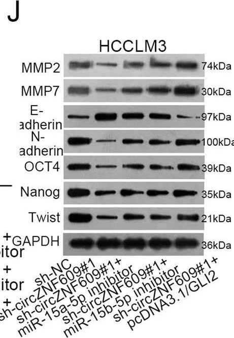 Fig.5.J showing Western Blotting from the publication: CircZNF609 enhances hepatocellular carcinoma cell proliferation, metastasis, and stemness by activating the Hedgehog pathway through the regulation of miR-15a-5p/15b-5p and GLI2 expressions.