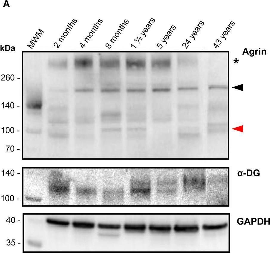Fig.3.A showing Western Blotting from the publication: Determination of Agrin and Related Proteins Levels as a Function of Age in Human Hearts.