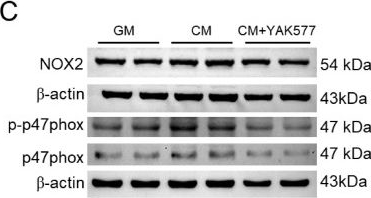 Fig.2.C showing Western Blotting in a Rattus norvegicus (Rat) sample from the publication: YAK577 Attenuates Vascular Calcification by Targeting an MMP14-NOX2/ROS Axis in VSMCs and a Vitamin D3-Induced Mouse Model.