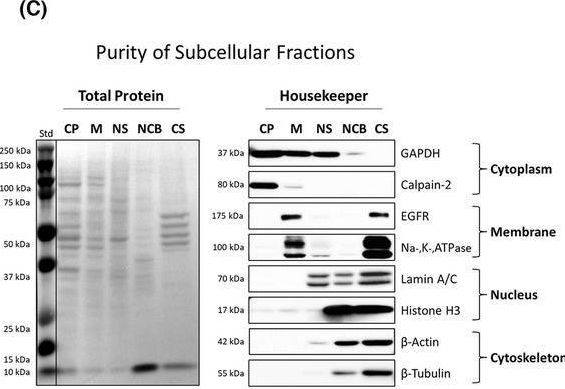 Fig.2.C showing Western Blotting from the publication: Subcellular localization of PD-L1 and cell-cycle-dependent expression of nuclear PD-L1 variants: implications for head and neck cancer cell functions and therapeutic efficacy.