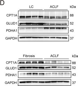 Fig.5.D showing Western Blotting from the publication: Cross-species hepatic transcriptomics identify conserved immune-metabolic reprogramming in acute-on-chronic liver failure progression.