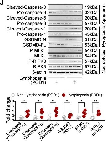 Fig.2.J showing Western Blotting in a Homo sapiens (Human) sample from the publication: Stress Hyperglycemia Drives CD4+ T Cell PANoptosis and Postoperative Organ Injury via Monocyte-Derived Succinate.
