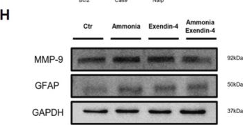Fig.3.H showing Western Blotting from the publication: Exendin-4 protects brain endothelial cell damage against hyperammonemic condition.