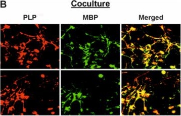 Fig.5.B showing Immunocytochemistry-immunofluorescence from the publication: Disrupted Myelination in FAHN: Insights from a Patient-Specific hiPSC Neuron-Oligodendrocyte Model.