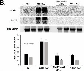 Fig.1.B showing Western Blotting in a Mus musculus (House mouse) sample from the publication: The critical role of the proto-oncogene c-Kit in TSC renal cystogenesis.