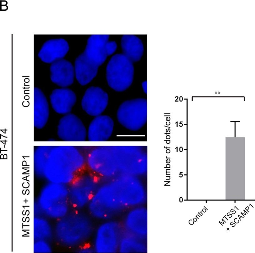 Fig.4.B showing Proximity Ligation Assay in a Homo sapiens (Human) sample from the publication: MTSS1 and SCAMP1 cooperate to prevent invasion in breast cancer.