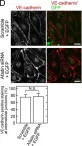 Fig.5.D showing Immunocytochemistry-immunofluorescence from the publication: An Adaptor Molecule Afadin Regulates Lymphangiogenesis by Modulating RhoA Activity in the Developing Mouse Embryo.