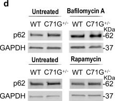 Expression of ALS-PFN1 impairs vesicular degradation in iPSC-derived microglia.
